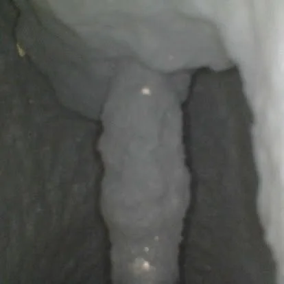 Component surface inspection